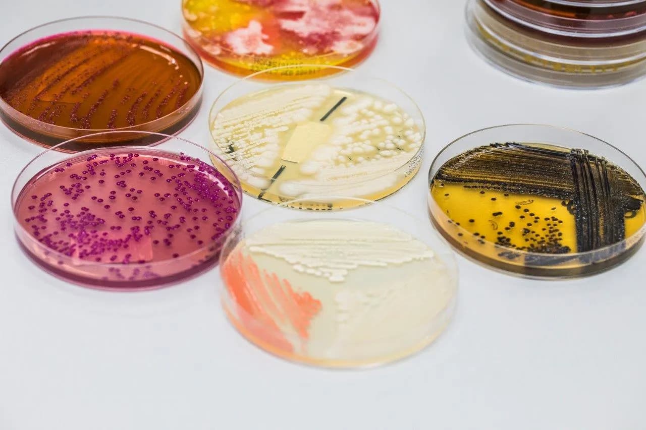 Petri dishes with bacterial cultures in the Labquest laboratory
