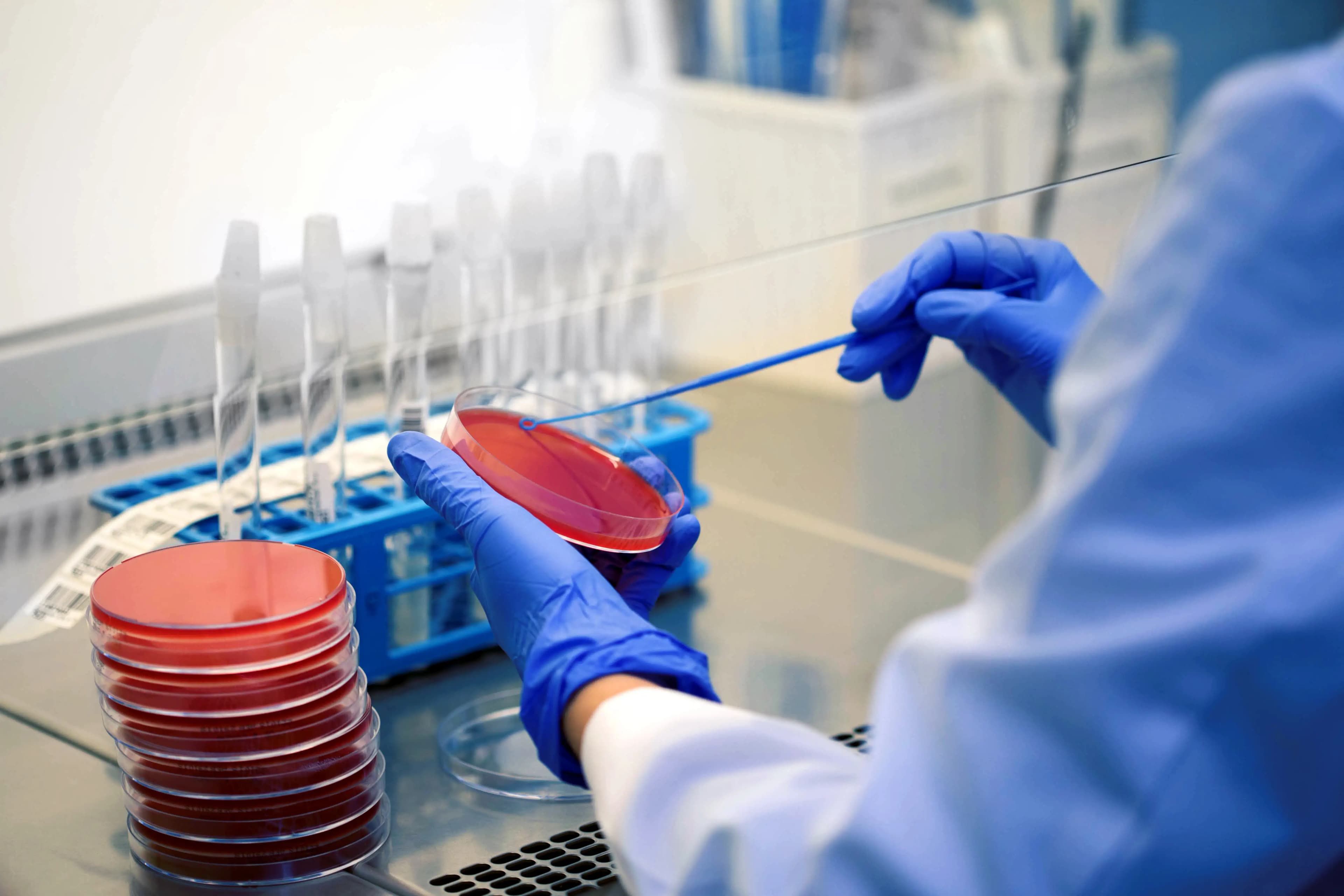 A lab technician in gloves prepares a Petri dish for culturing